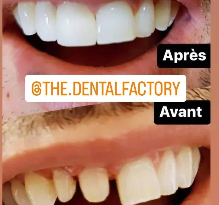 RÉALISATION N°4